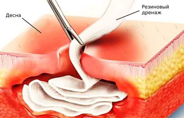 Резиновый дренаж