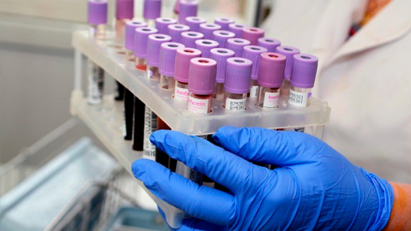 Определение магния в плазме крови