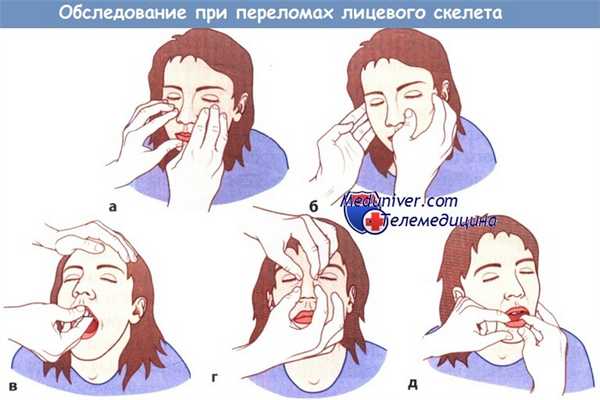 Обследование при переломах костей лица