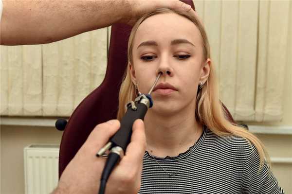 Полипотомия носа риношейвером.jpg