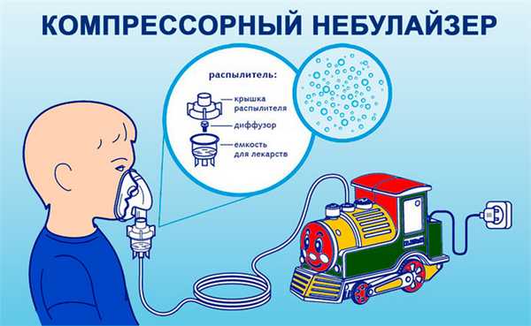 Небулайзер