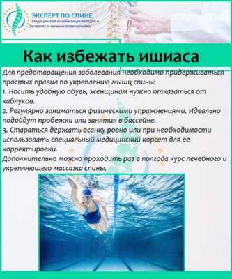 Как предотвратить ишиас