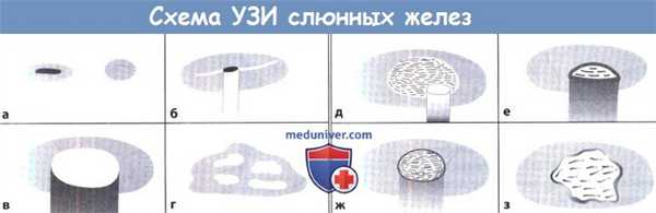 Схема УЗИ слюнных желез