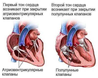 zabolevania-serdca-12