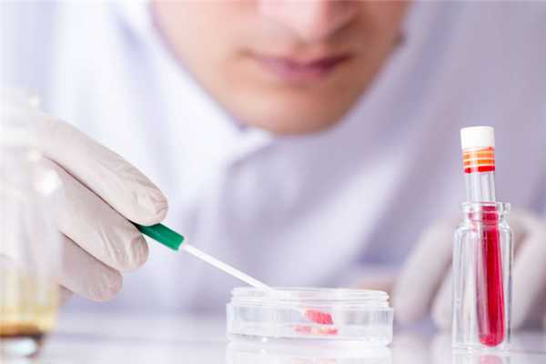 Диагностика агранулоцитоза