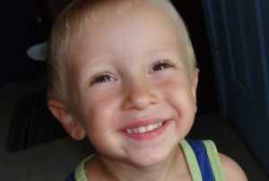 Синдром Ангельмана