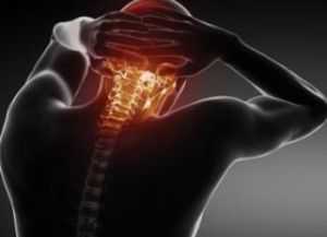 шейная мигрень