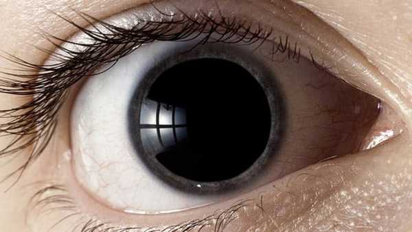 расширенный зрачок