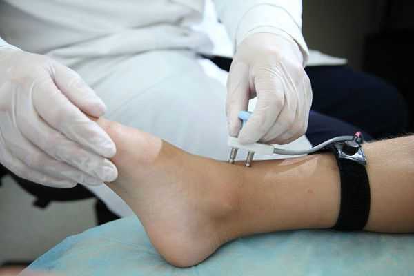 Электромиография