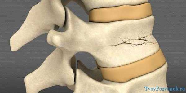 Трещина в диске