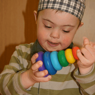 Фотогалерея детей с синдромом Дауна