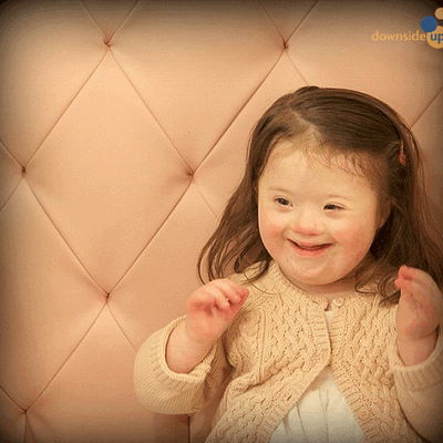 Фотографии детей с синдромом Дауна