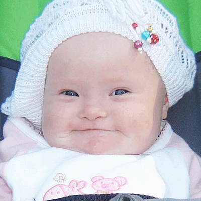 Фотогалерея детей с синдромом Дауна