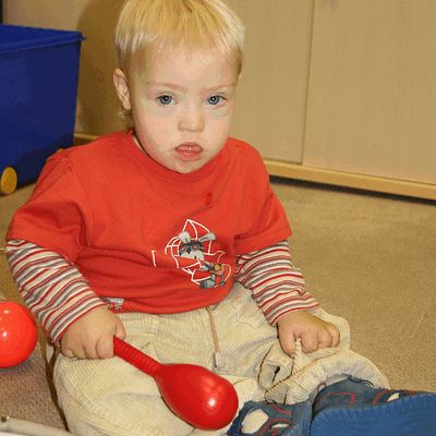 Фотогалерея детей с синдромом Дауна