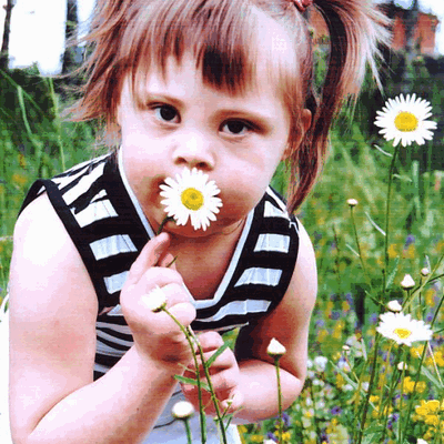 Фотогалерея детей с синдромом Дауна