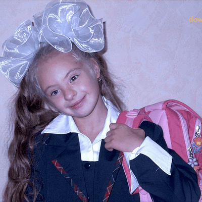 Фотогалерея детей с синдромом Дауна