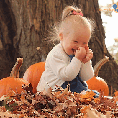 Фотографии детей с синдромом Дауна