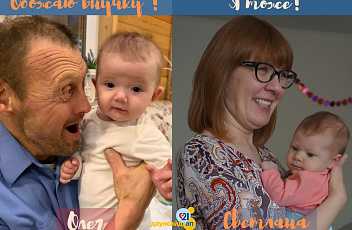 Человек с синдромом молодого дауна, портрет улыбающегося лица