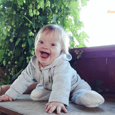 Фотогалерея детей с синдромом Дауна