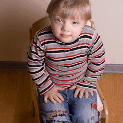 Фотогалерея детей с синдромом Дауна