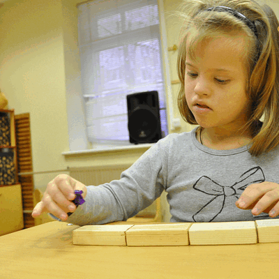 Фотогалерея детей с синдромом Дауна