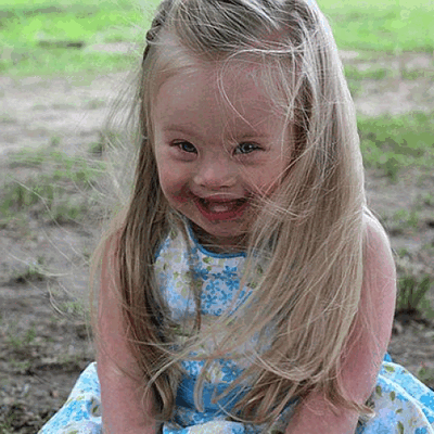 Фотографии детей с синдромом Дауна