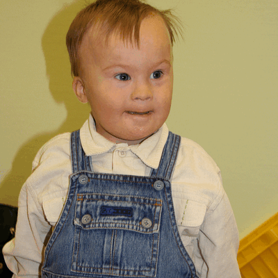 Фотогалерея детей с синдромом Дауна