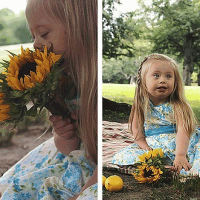 Фотографии детей с синдромом Дауна