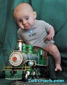 Синдром Дебре-Фибигера