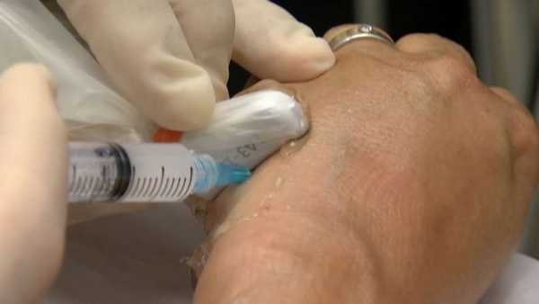 болезнь де кервена лечение в москве