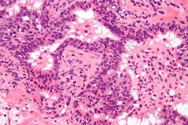 Причины и классификация синдрома Лайелла