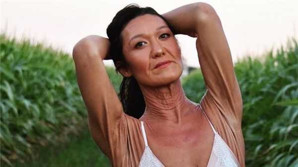 26-летняя Сара Гертс, модель и инфлюенсер с синдромом Элерса — Данлоса