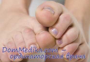 болезнь эйленбурга