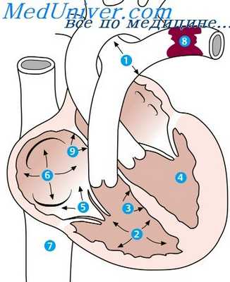 синдром эйзенменгер