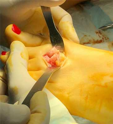 суставы пальцев ног