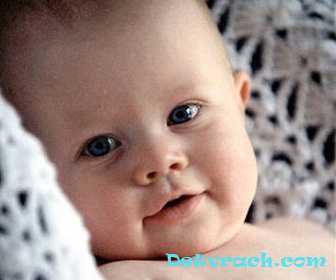 Синдром Фримена-Шелдона (FSS)