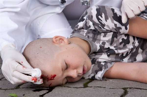 Травма головы