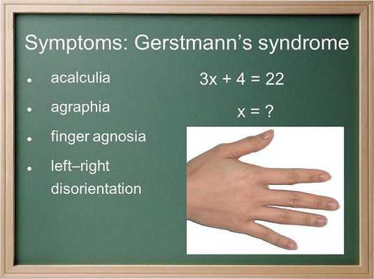 Gerstmann Syndrome symtoms