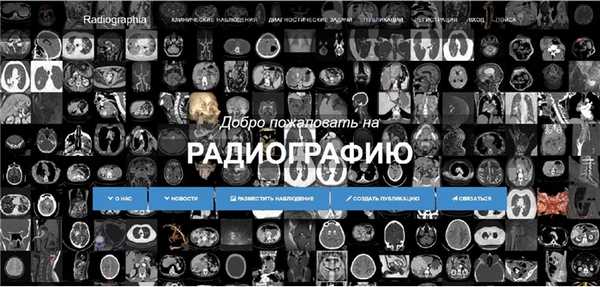 Радиография