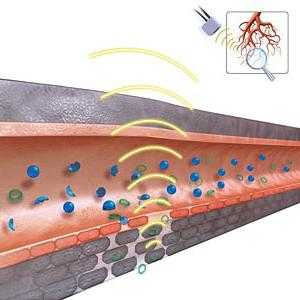 болезнь гирке лечение