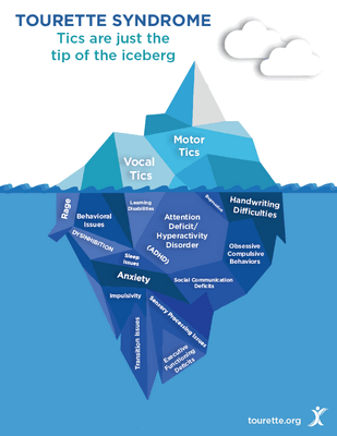 Синдром Туретта