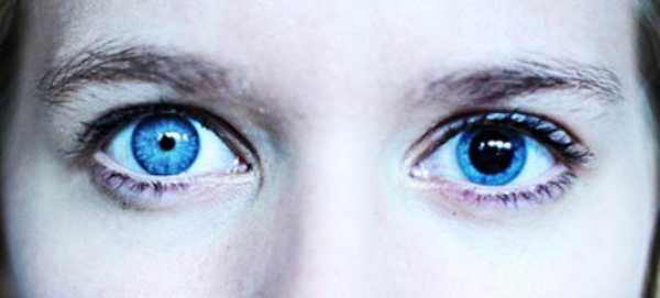 причины анизокории