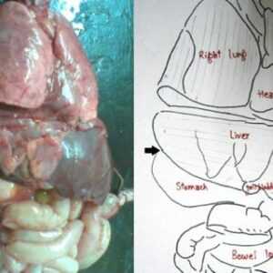 сердце по середине у ребенка