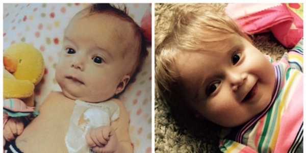 Синдром ивемарка у детей фото