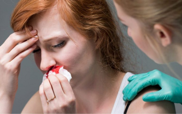 Носовое кровотечение - коагулопатия капиллярного типа