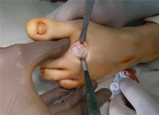 келлер 2 операция доступ