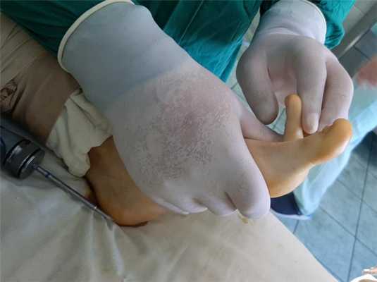 келлер 2 результат операции