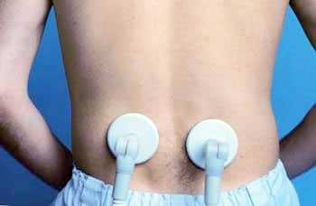 При лечении боли в спине устранение отёчности, воспаления, болезненности, восстановление объёма движений в суставах и мышцах поясницы ускоряется при использовании физиотерапии.