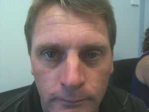 лечение патологии