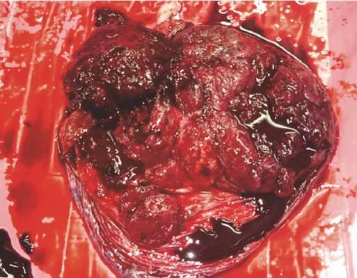 Матка Кувелера